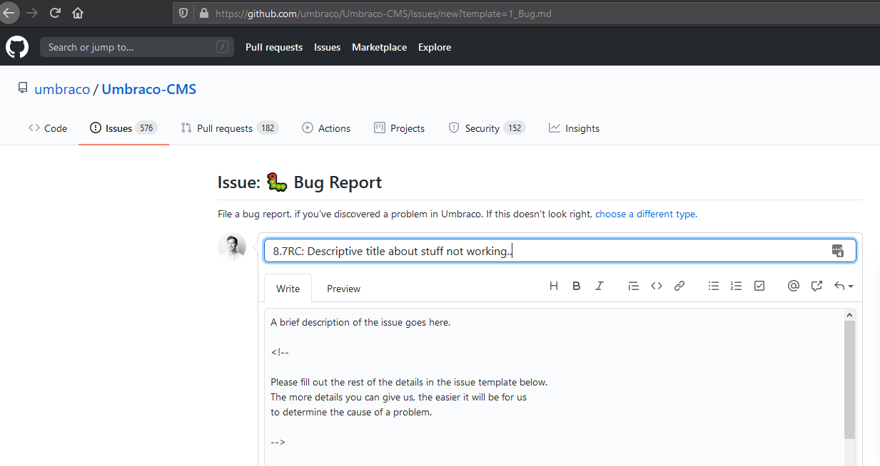 01 Github Issue
